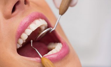 traitement en cas de problèmes dentaires